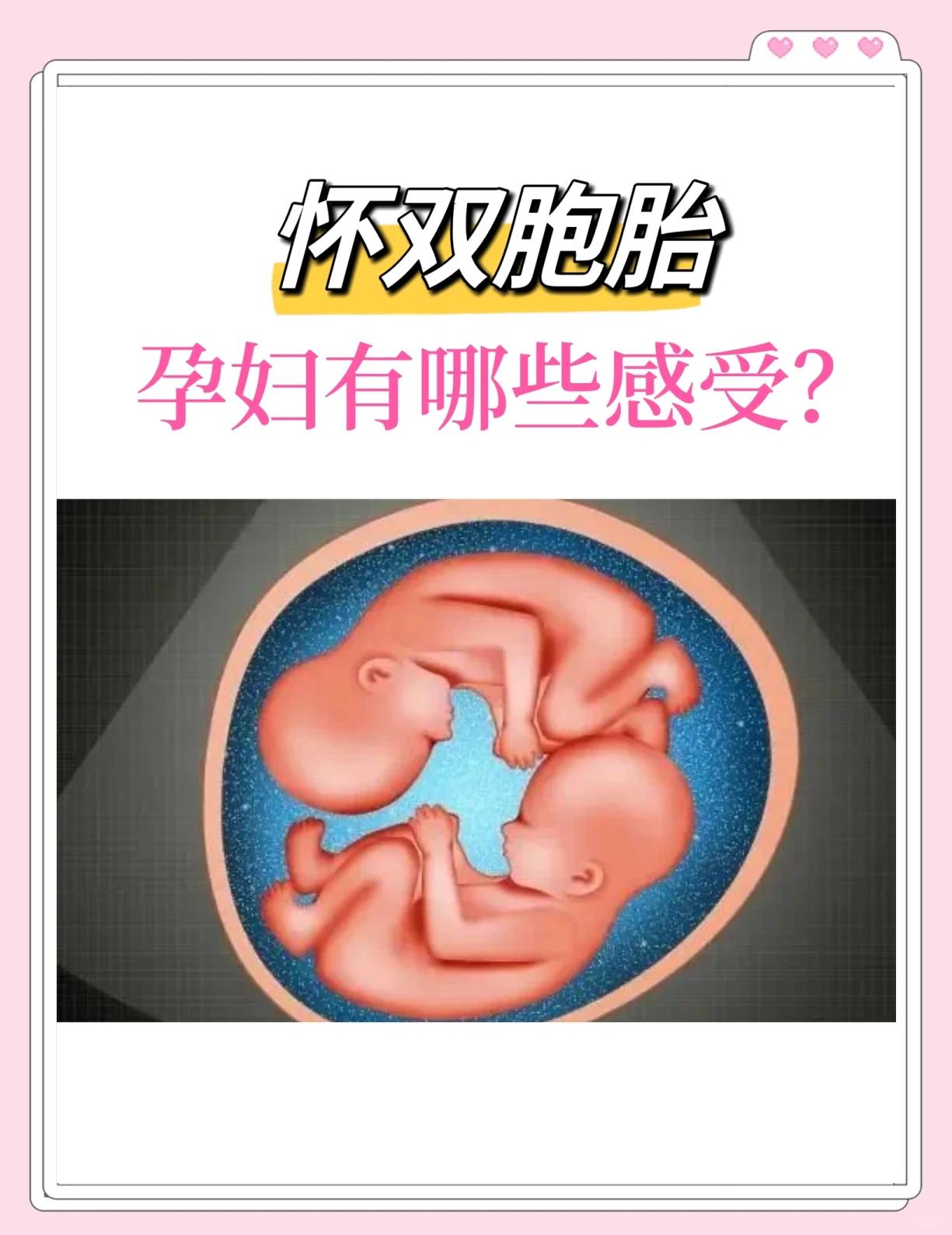 五万分之一的概率！麦迪逊女友又怀双胞胎已育有3娃(麦迪逊是男名吗)